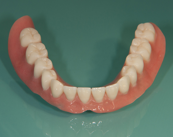 Zeramex loc Locator, Zeramex P Implantat, Novaloc, Valoc, PEEK Geru00fcst